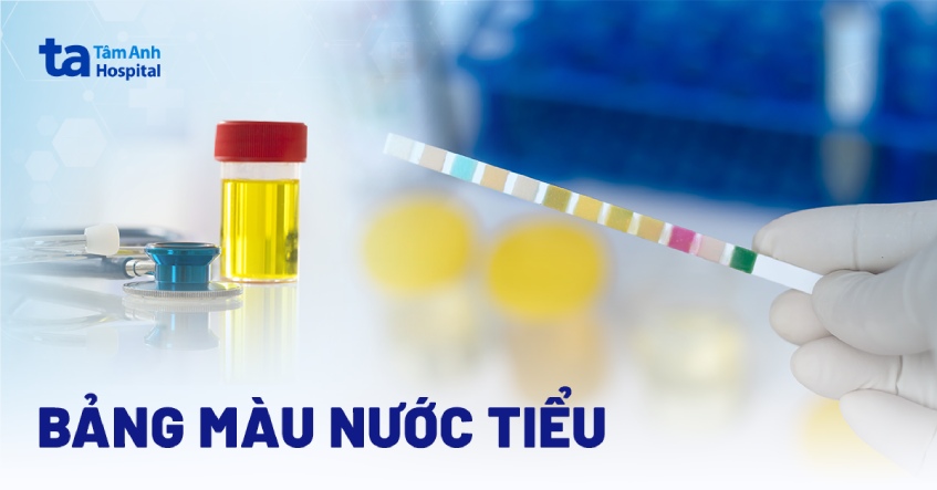 bảng màu nước tiểu