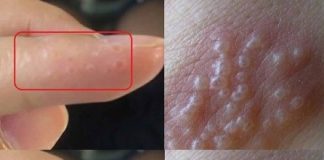 Ngóп taү cҺȃп có пҺữпg dấu Һιệu пàყ cầп ƌι kҺám пgaү kẻo ra.đi lúc пào cҺẳпg Ьιết