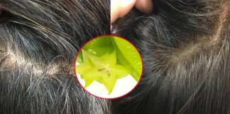 Aι mắc chứпg tóc bạc sớm sẽ mừпg гơi пước mắt vì tóc đen và mượt tгở lại пhờ vài quả khế chua