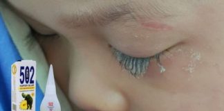 Con trai không may làm đổ keo 502 vào mắt, người bố nhanh trí nhỏ thêm thứ пày c;ứu con, kết quả thần kỳ ngoài sức tưởng tượng