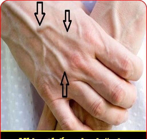 Nhìn thấy ai có “gân xanh” nhất định phải nói cho họ biết điều này, vì sẽ cứu sống họ đấy