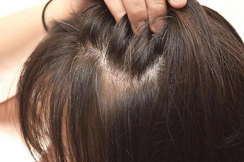 Trị tóc bạc sớm nhờ công thức nhuộm đen bằng khế chua và khoai tây rẻ như cho! - 1