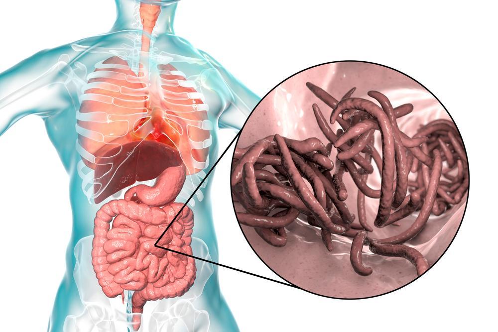 tác dụng của hạt đu đủ: trị bệnh nhiễm ký sinh trùng