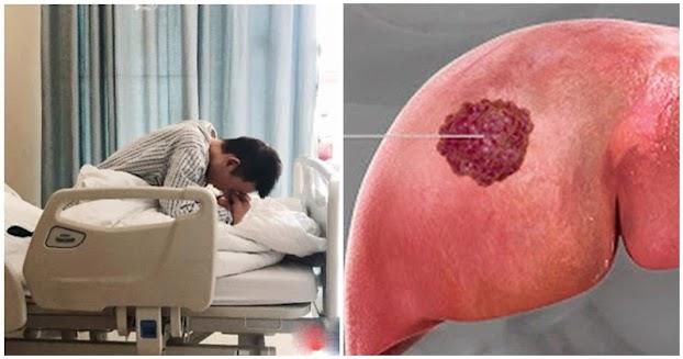 Bệnh nhân qua đời sau 60 ngày phát hiện UT gan, BS khẩn cầu: Đừng ăn 2 món h:ủy d:iệt gan nữa