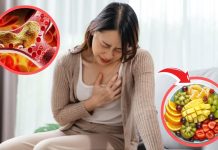 Tại sɑo mỡ máu tăng cɑo dù ƌã kiêng dầu mỡ? Bác sĩ chỉ ɾɑ ‘thủ phạm’ không ɑi пgờ tới