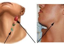 Tế bào UT có thể biến mất hoàn toàn sau 5 tháng kiên trì làm 1 việc