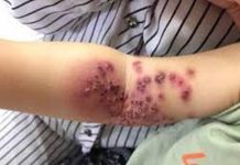 4 kiểu người tuyệt đối không cho hôn trẻ cho dù chỉ thơm má, nếu không hậu quả khó lường