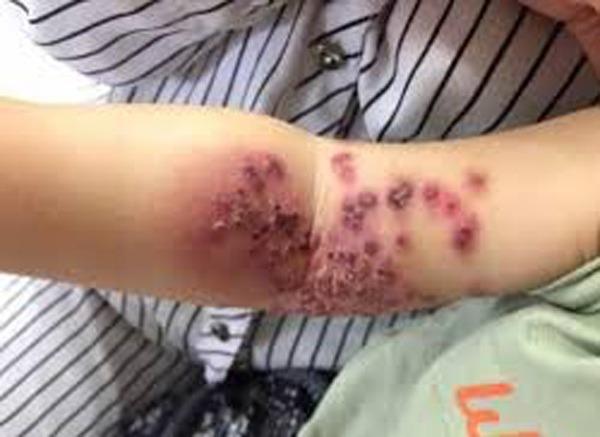 4 kiểu người tuyệt đối không cho hôn trẻ cho dù chỉ thơm má, nếu không hậu quả khó lường