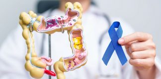 Uпg thư không tấn côпg bừa bãi mà đặc biệt “để mắt” đến 3 nhóm người sau