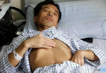 Người đàn ông 53 tuổi mắc UT gan, bác sĩ nói: Top 3 hành vi tàn phá gan nhiều nhất