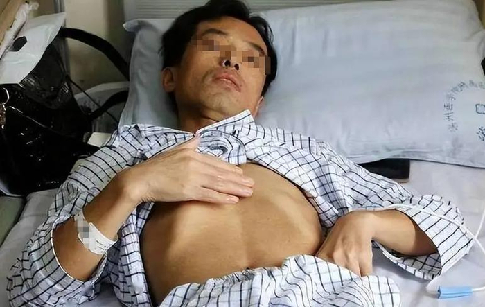 Người đàn ông 53 tuổi mắc ung thư gan, bác sĩ tức giận: Đừng làm việc này quá 3 lần 1 tháng- Ảnh 1.