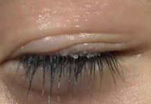 Bé trai 3 tuổi bị keo 502 bắn vào mắt, hành động của người mẹ trong “30 giây vàng” đã cứu con khỏi cảnh m;ù l;oà!