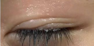 Bé trai 3 tuổi bị keo 502 bắn vào mắt, hành động của người mẹ trong “30 giây vàng” đã cứu con khỏi cảnh m;ù l;oà!