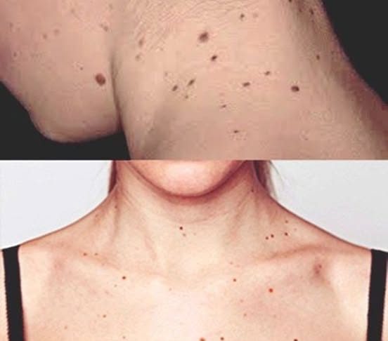 Người sắp bị K tấn công thường có 3 dấu hiệu lạ ở cổ, có dù chỉ 1 cũng báo động sức khoẻ